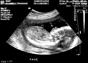 Complete Obstetrical
